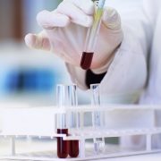 Press release from The Helmholtz-Centre for Environmental Research GmbH
